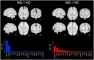 Functional Connectivity Alterations Reveal Complex Mechanisms Based on Clinical and Radiological Status in Mild Relapsing Remitting Multiple Sclerosis